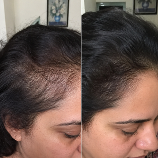 Blissmetics Hair Growth Oil 250ml